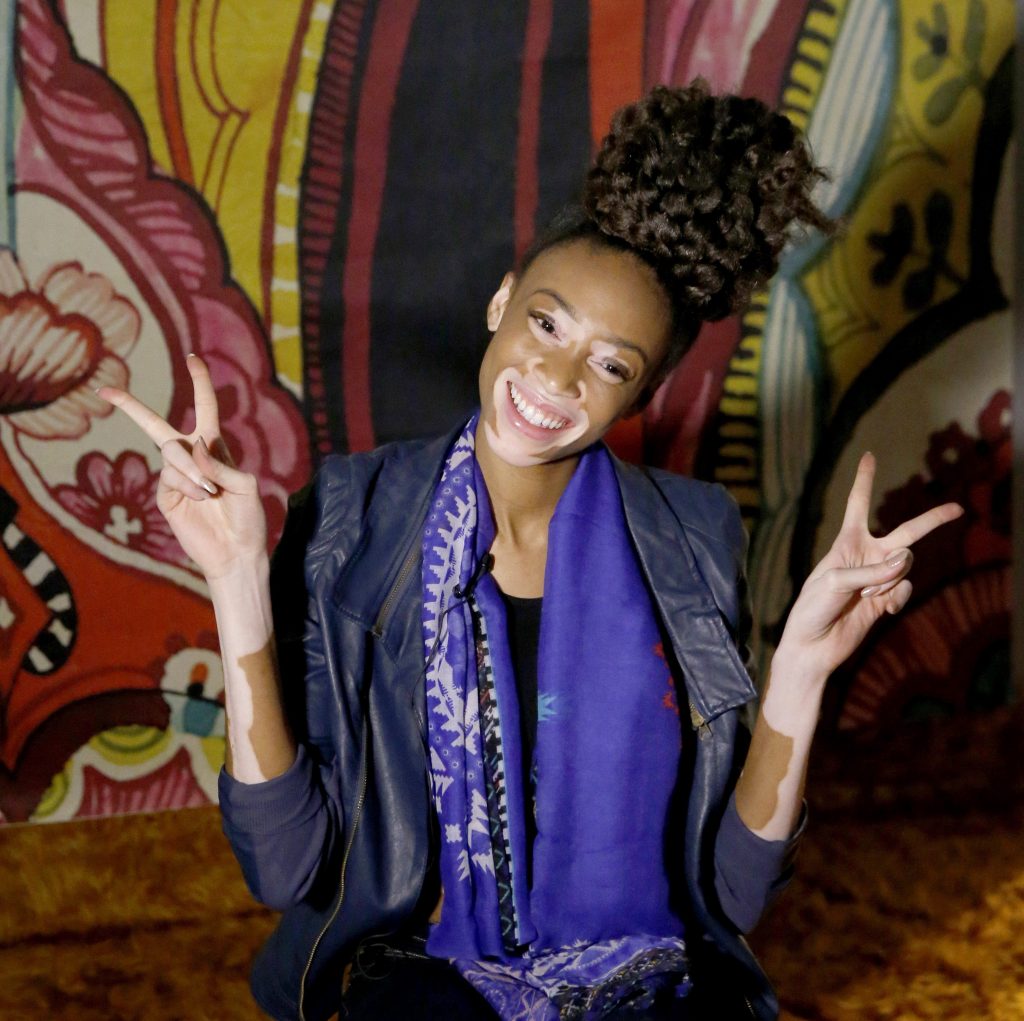 ESPAÑA MADRID FASHIONWEEK:GRA391. MADRID, 06/02/2015.- La modelo Winnie Harlow, saluda a los fotógrafos poco antes de prepararse para el desfile de la firma Desigual con el que se abre esta noche la Mercedes Benz FashionWeek Madrid, que se celebra hasta el próximo 11 de febrero en el recinto ferial de Ifema en Madrid. En total desfilarán treinta diseñadores, once creadores noveles -agrupados en la plataforma Samsung Ego-, y tres firmas originarias de Portugal, país invitado de esta edición, que mostrarán durante seis jornadas las tendencias que vestirán el próximo otoño-invierno 2015. EFE/J.J. Guillén
