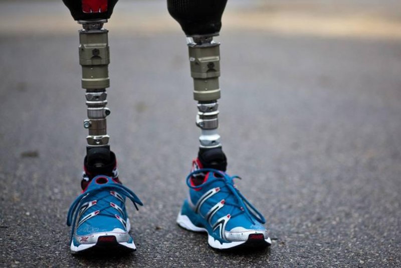 gonzalo-morales-divo-las-pr-tesis-tambi-n-se-imprimen-en-3d