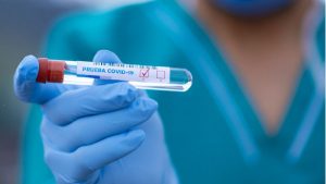 La Sociedad Venezolana de Infectología considera que deben habilitarse más lugares para realizar pruebas PCR