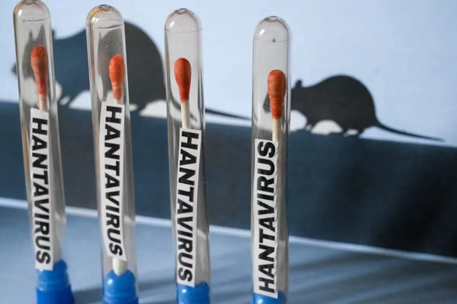 El Ministerio de Salud confirmó este 21 de julio el fallecimiento de tres personas en el estado Anzoátegui debido a un brote de hantavirus. El anuncio oficial busca esclarecer la situación epidemiológica tras diversas alertas gremiales sobre una nueva patología letal en el país.